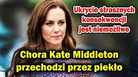 Chora Kate Middleton przechodzi przez piekło Ukrycie strasznych