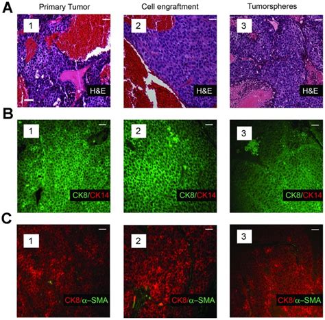 A Histopathology Of A Primary Mammary Tumor From An MMTV Neu