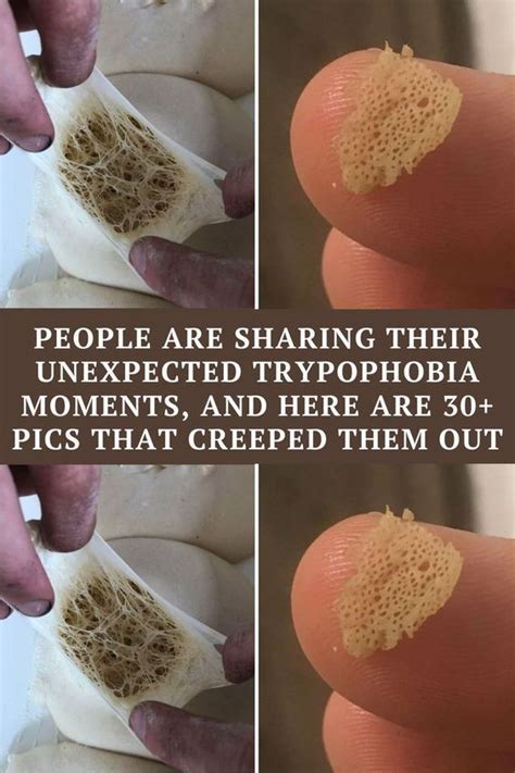 Fear Factor These Trypophobia Photos Make Us Feel Really Weird Trypophobia Trypophobia Skin