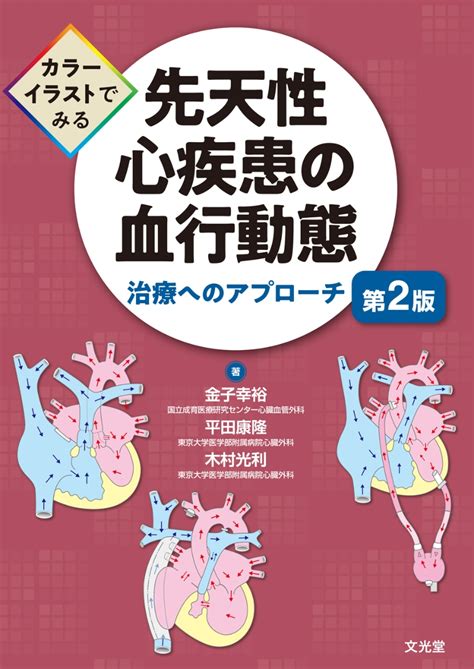 楽天ブックス カラーイラストでみる 先天性心疾患の血行動態 第2版 治療へのアプローチ 金子 幸裕 9784830619717 本