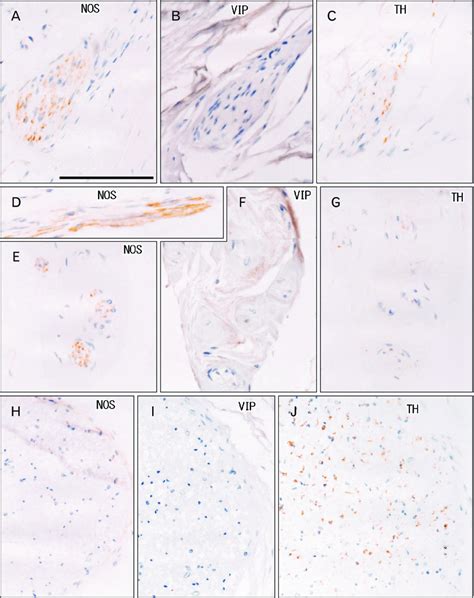 Immunohistochemistry Of Nerves An 89 Year Old Man Frontal Sections