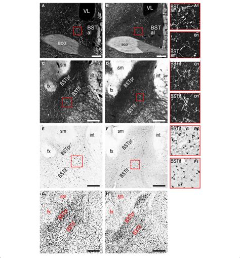 LHAjv Region Connections With The Bed Nucleus Of The Stria Terminalis