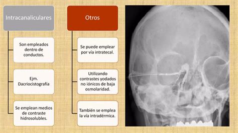 Medios De Contraste Pptx Ppt