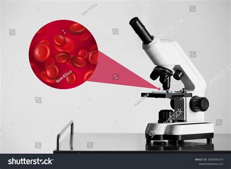 examination blood sample  microscope laboratory stock photo