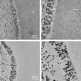 Expression changes of cysteine cathepsins in response to TGF-b ...