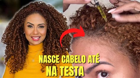 SEU CABELO ESTÁ CAINDO USE ISSO PARA CRESCER MUITO CABELO FIO GROSSO