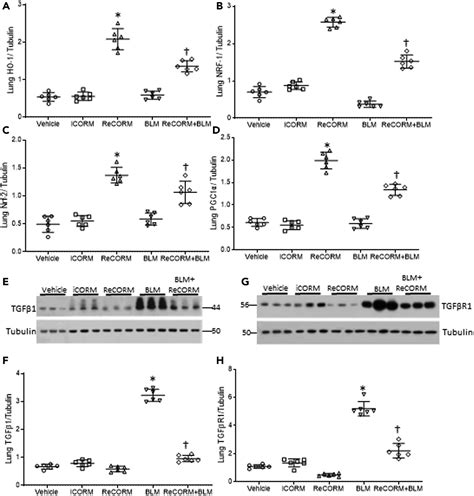 Nuclear Respiratory Factor 1 Negatively Regulates Tgf β1 And Attenuates