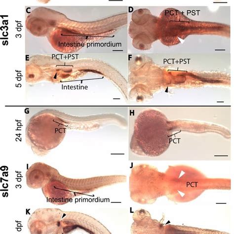 Images Of Cryo Cross Sections From Whole Mount In Situ Hybridization