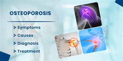 Osteoporosis Symptoms Causes Diagnosis And Treatment