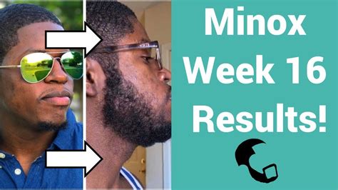 Growing A Beard With Minoxidil A Black Mans Experience Week 16 Update