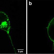 Cellular Localization Of Gfp Tagged Wild Type And Mutant Kir