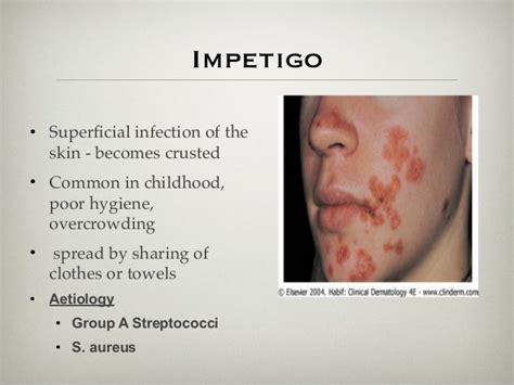 Skin And Soft Tissue Infections