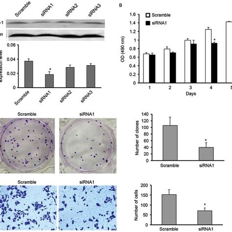 SiRNAmediated Knockdown Of HAX1 Expression Inhibits Cell Viability