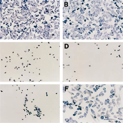 Increased Cct Expression Prevented Et Och Triggered Apoptosis