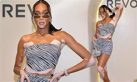 Winnie Harlow Puts On Leggy Display In Zebra Top And Mini Skirt