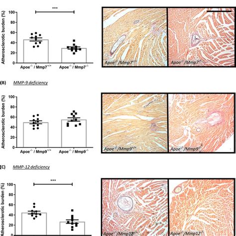 Effect Of MMP Inhibition And TIMP Modulation On Coronary Artery