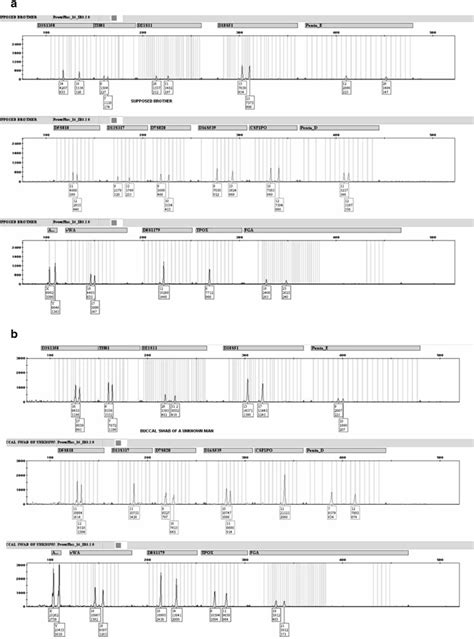 Results Of Genetic Analysis Using Powerplex®esx17 A Supposed Brother Download Scientific