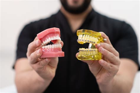 Clear Aligners Vs Braces Key Differences In Orthodontic Treatments