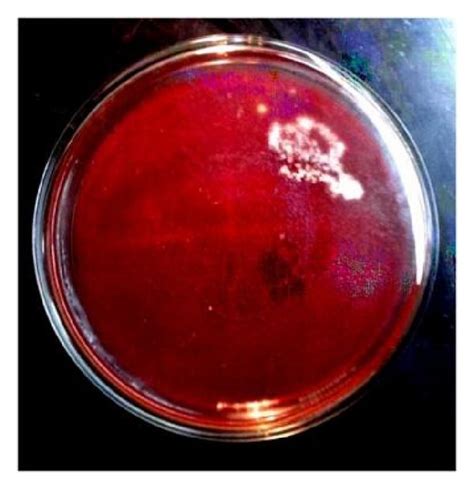 Dry Raised Chalky White Colonies Of Nocardia On Blood Agar