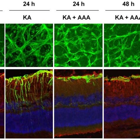 AAA Decreases GFAP Expression In Muller Cells But Not In Astrocytes