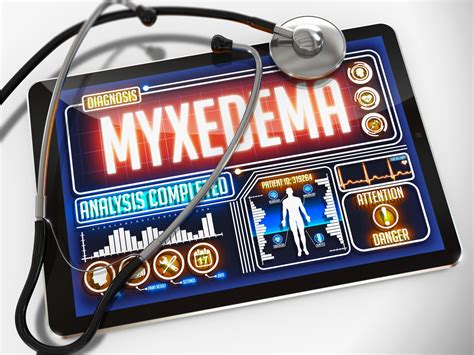 Myxedema Coma More On The Most Severe Type Of Hypothyroidism