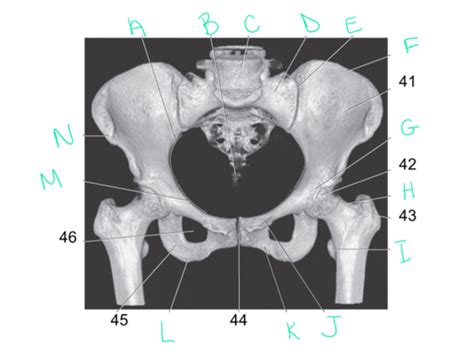 Cross Sectional Anatomy Pelvis Flashcards Quizlet