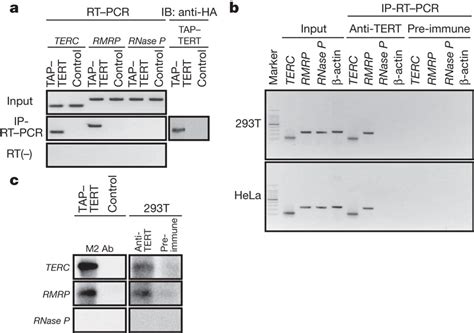 Tert And Rmrp Interacta Detection Of Rmrp And Terc Rna Species