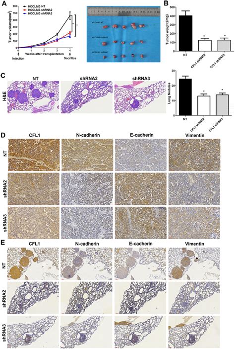 Cfl Knockdown Represses Hcc Growth And Lung Metastasis In Mice A