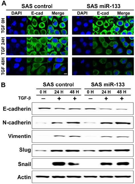 Mir 133 Dependent Facilitation Of Tgf β Induced Epithelialmesenchymal