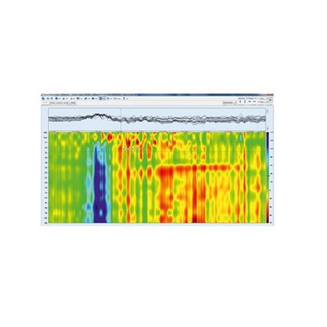 Logiciel Neurologique Tpm Elmiko Medical Equipment Pour Eeg De