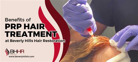 Prp Hair Treatment Benefits Beverly Hills Hair Restoration