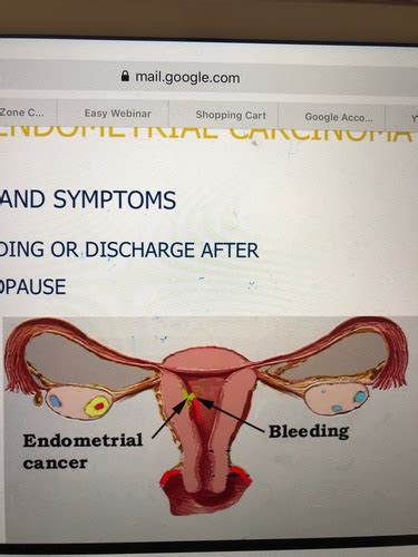 Obstetrics Gynecology Class Flashcards Quizlet