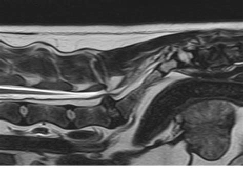 Infiltración epidural como alternativa terapéutica en casos de