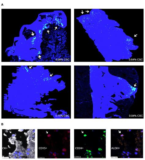 Frontiers Chordoma Cancer Stem Cell Subpopulation Characterization