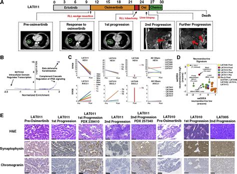 Clonal Evolution And Heterogeneity Of Osimertinib Acquired Resistance