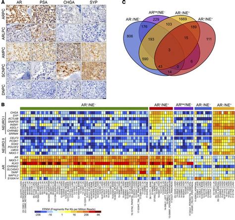 Jci Molecular Profiling Stratifies Diverse Phenotypes Of Treatment