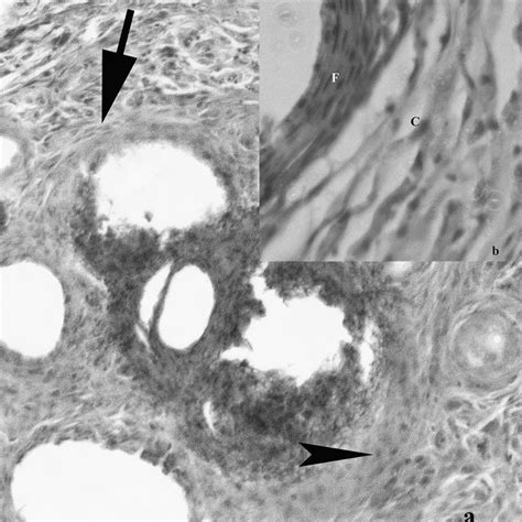 A Granulomatous Tissue At Various Stages Of Development 10x