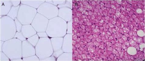 A Light Microscope Image Of White Adipose Tissue And B Brown