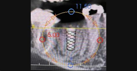 Cone Beam CT - Dental Surgeons and Implant Centers