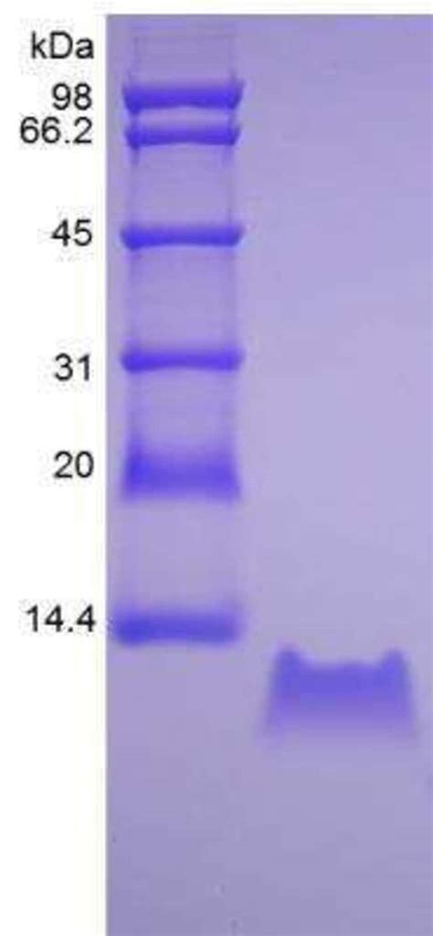 Novus Biologicals Recombinant Human Cxcl Gro Gamma Cinc Dcip