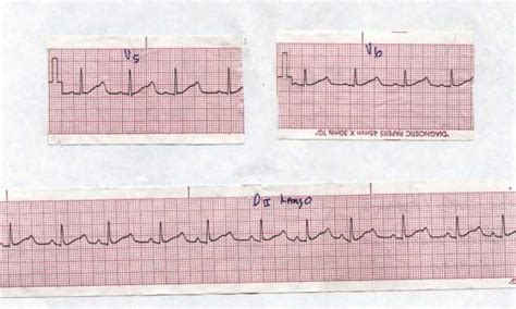 Images PEDIAT PCVC Mailing List 1st Virtual Congress Of Cardiology