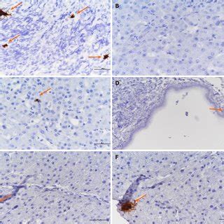 RNAscope in situ hybridization tests for the presence of... | Download ...