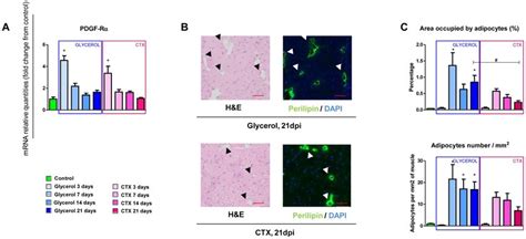 Ectopic Adipogenesis Occurs In Both Glycerol And Ctx Induced Muscle