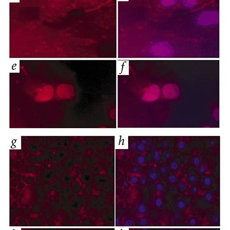 HCC Fluorescent Immunocytochemical And Immunohistochemical Staining Of