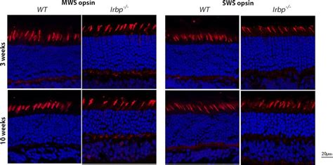 Cone Opsin Expression In Irbp And WT Mice At 3 And 10 Weeks Of Age