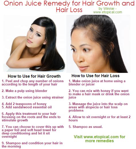 Onion Juice for Hair Growth, Loss, Greying, Is it Good, How to Make ...