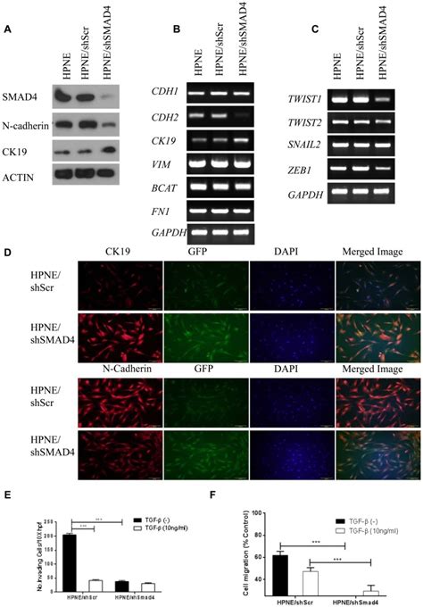 A Western Blot Analysis Of Cell Expression Of Smad4 And N Cadherin