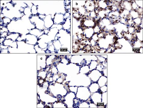 Photomicrographs Of Immunohistochemical Staining For 8 Ohdg Of Rats’ Download Scientific