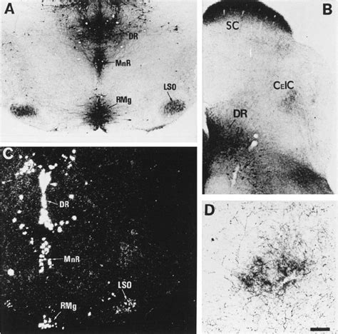 5 Ht Uptake In Neurons Of The L So Coronal Sections Through The