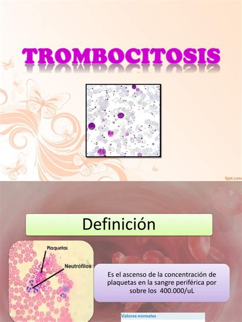 Trombocitosis Pdf Plaqueta Especialidades Medicas